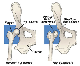 what is canine hip dysplasia